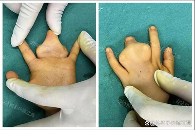 info-1081-721 info-1081-721