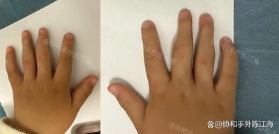 info-1080-518 info-1080-518