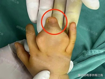 info-1078-809 info-1078-809